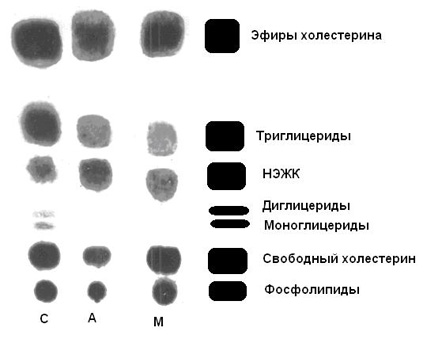 Как нарисовать хроматограмму